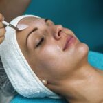 Chemical Peel Cost in Delhi: What to Expect