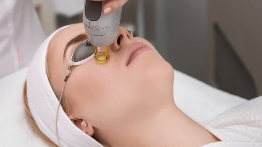 Fractional CO2 Laser Treatment in Delhi - Dr Rashmi Sharma
