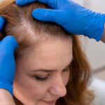 PRP GFC Therapy in Delhi NCR: The Revolutionary Hair & Skin Treatment Everyone’s Talking About