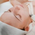 Discover the Power of Dermafrac at KARA by Dr. Rashmi Sharma