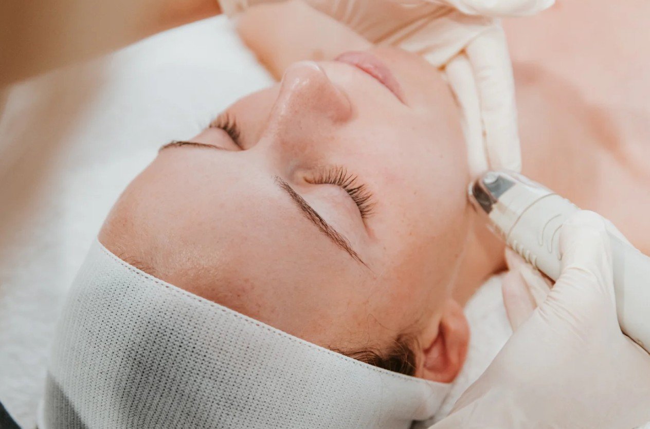 Discover the Power of Dermafrac – Dr. Rashmi Sharma