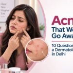 Acne That Won’t Go Away? 10 Questions to Ask a Dermatologist in Delhi