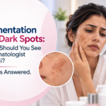 Pigmentation and Dark Spots: When Should You See a Dermatologist in Delhi? 10 FAQs Answered