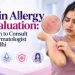 Skin Allergy Evaluation: When to Consult a Dermatologist in Delhi